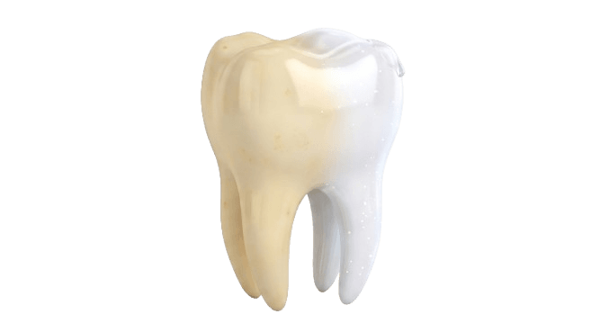 Blanqueamiento Dental